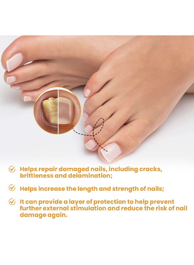 ximonth Nail Fungus Treatment Sticker, Multi-Purpose Nail Repair Patches- Nail Repair for Damaged Nails, Nail Treatment Restores Appearance- 32 Counts - Image 5