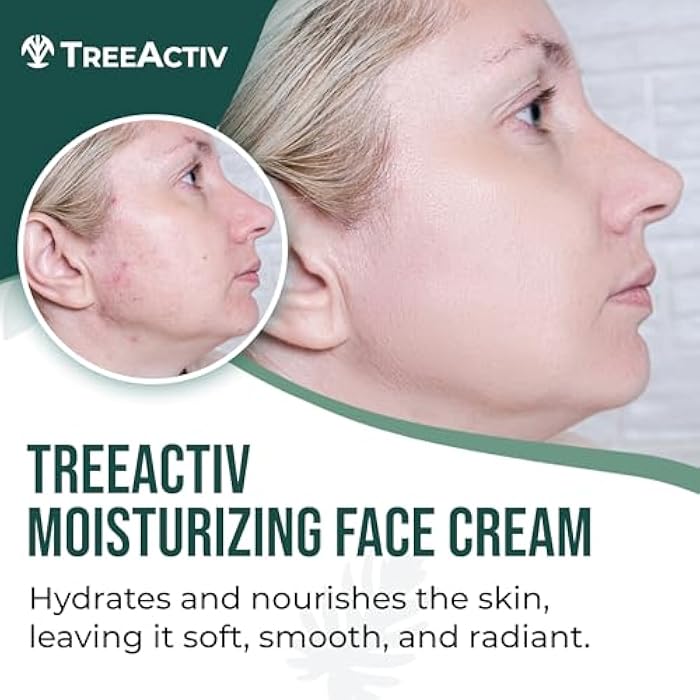 TreeActiv Acne Cream Original Formula, 2 fl oz, 2% Salicylic Acid Face Moisturizer for Oily & Acne-Prone Skin, Lightweight Hydrating Facial Cream - Image 2
