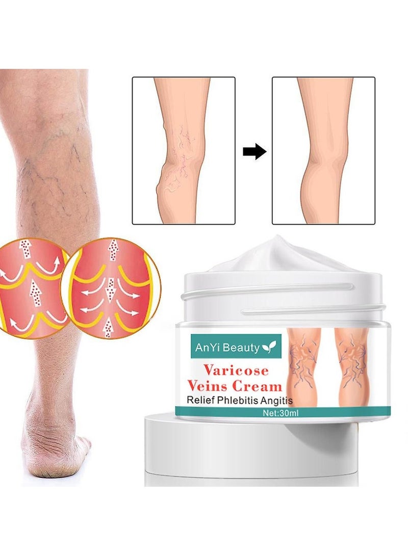 ANYI Varicose Vein Cream  - Image 1