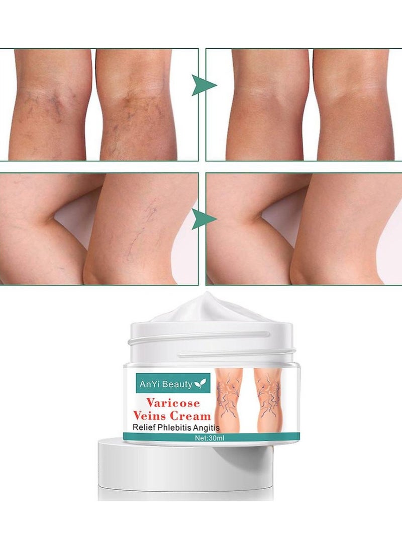 ANYI Varicose Vein Cream  - Image 3