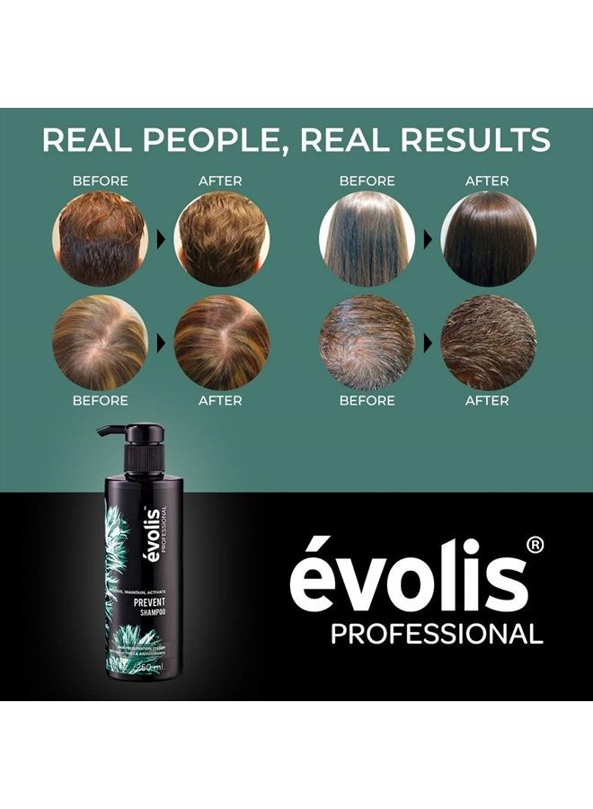 evolis شامبو إيفوليس PREVENT - شامبو مضاد لتساقط الشعر - شامبو تساقط الشعر للرجال والنساء - شامبو طبيعي لتساقط الشعر - علاج وقائي لتساقط الشعر (8.5 أونصة سائلة) - Image 3