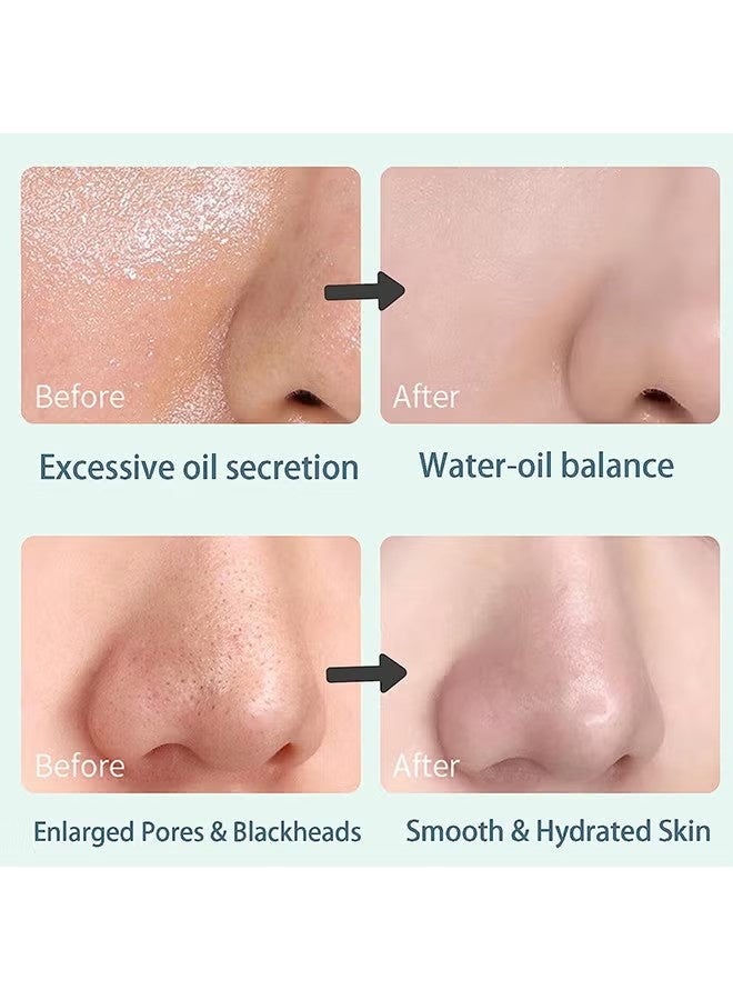 باروبت Mugwort حب الشباب الطين عصا, Mugwort مكافحة المسام والحب الشباب الطين قناع, تنظيف قناع الطين قناع للرجال والنساء, ترطيب زيت التحكم تقلص إزالة الرؤوس السوداء, تقلص المسام تحسين لون الجلد - Image 3