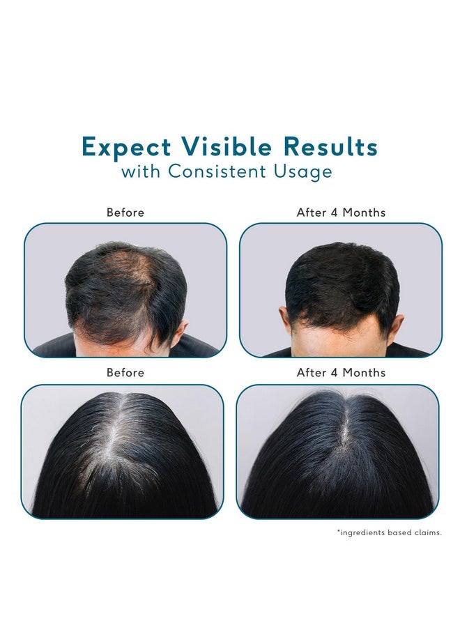 HEALTHKART - Hk Vitals Headful Growth Serum With 3% Redensyl, 2% Anagain, & 2% Cressatine (30Ml) | For Hair Growth & Strong Hair | Dermatologically Tested - Image 1