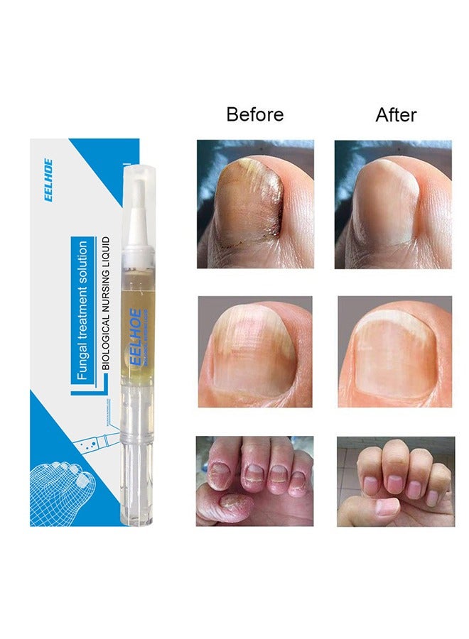 EELHOE Fungal Treatment Solution，Nail Fungus Nursing Liquid，Daily Hands And Feet, Nail Care, Nail Lotion, Thickening Soft Nails 3ml - Image 2