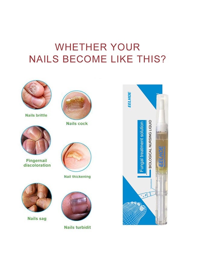 EELHOE Fungal Treatment Solution，Nail Fungus Nursing Liquid，Daily Hands And Feet, Nail Care, Nail Lotion, Thickening Soft Nails 3ml - Image 3
