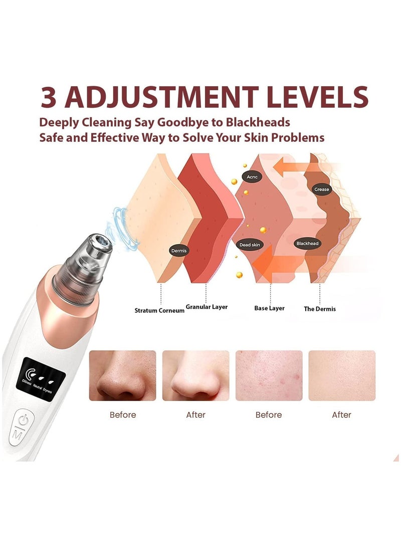 RATSAW Blackhead Remover Pore Vacuum Electric Facial Suction Cleaner USB Rechargeable Acne Comedone Whitehead Extractor LED Display Upgraded Blue Light with 4 Replaceable Probes for Women and Men - Image 4