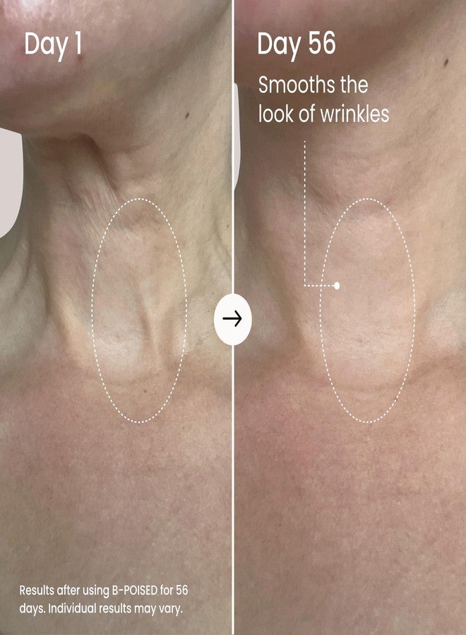 MAELYS Cosmetics B-POISED Neck & Décolleté Firming Cream for Tightening and Firming - Neck Cream for Sagging Skin - Smooths The Look Of Fine Lines and Wrinkles in the Décolleté Area - Image 3
