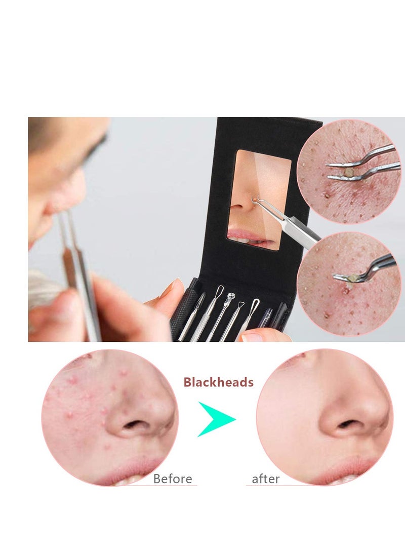 SYOSI - 6 Pcs Stocking Stuffers Blackhead Remover Kit Ingrown Hair Removal White Heads Removers Pore Extraction Tool Facial Skin - Image 1