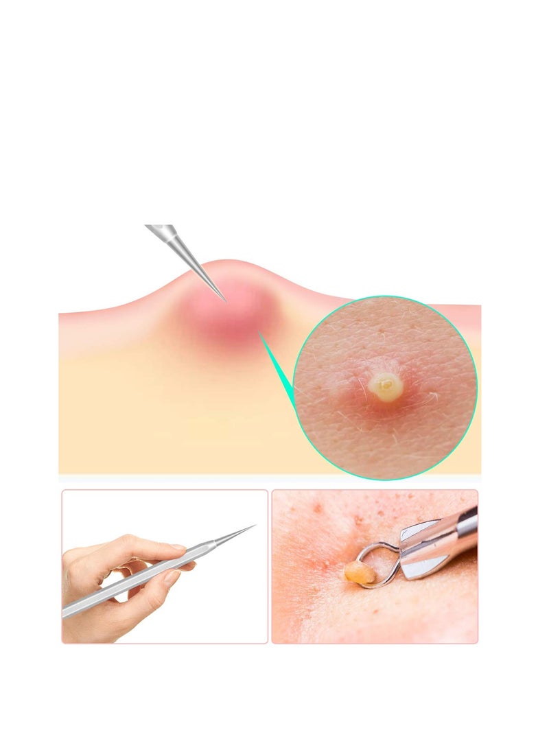 SYOSI - 6 Pcs Stocking Stuffers Blackhead Remover Kit Ingrown Hair Removal White Heads Removers Pore Extraction Tool Facial Skin - Image 1