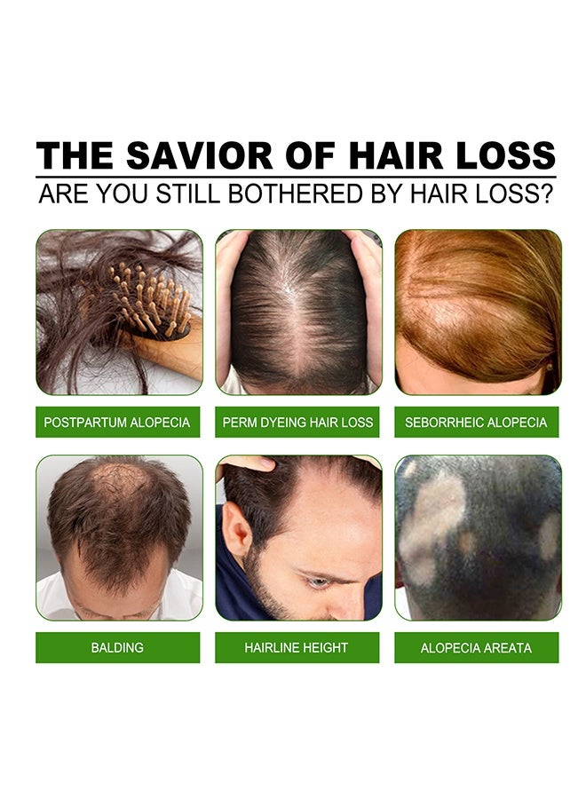 Jaysuing Hair Treatment Green Ginger Serum Hair Lotion ,Hair Loss Treatments, Aids against Hair-thining, Hair Regrowth Treatment-120ML - Image 5