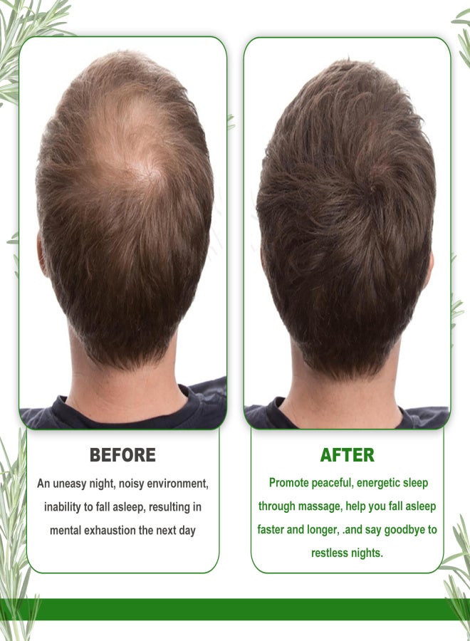 إيلهو زيت إكليل الجبل العطري من إيلهو، 60 مل، للعناية بالشعر، نقي وطبيعي، يقوي بصيلات الشعر، يسرع نمو الشعر، يقلل تساقط الشعر، مع فرشاة الرموش وفرشاة تحديد العيون. - Image 5