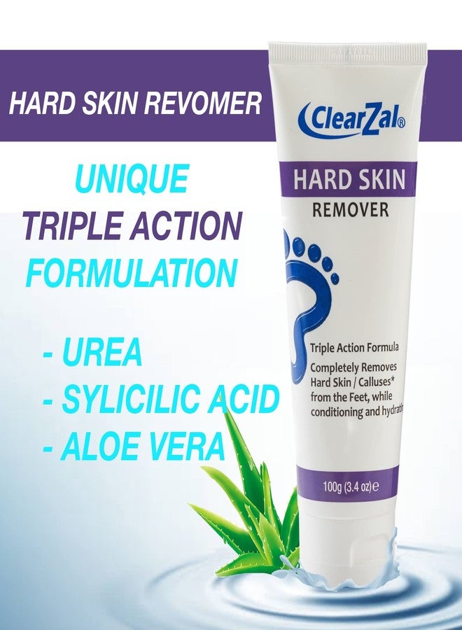 ClearZal Foot Cream For Hard Skin, Helps Calluses and Corn Removal While Leaving Soft Smooth Skin, Hydrating and Conditioning Triple Action Formula With Aloe Vera, 3.4 Ounce Tube - Image 2