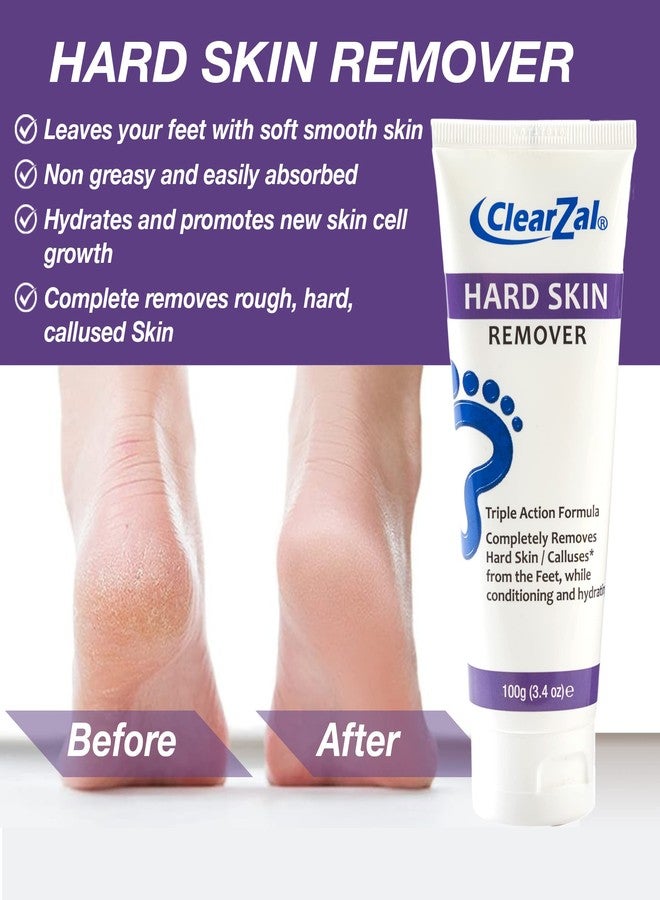 ClearZal Foot Cream For Hard Skin, Helps Calluses and Corn Removal While Leaving Soft Smooth Skin, Hydrating and Conditioning Triple Action Formula With Aloe Vera, 3.4 Ounce Tube - Image 4