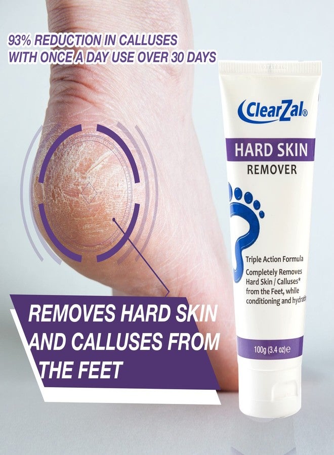 ClearZal Foot Cream For Hard Skin, Helps Calluses and Corn Removal While Leaving Soft Smooth Skin, Hydrating and Conditioning Triple Action Formula With Aloe Vera, 3.4 Ounce Tube - Image 3