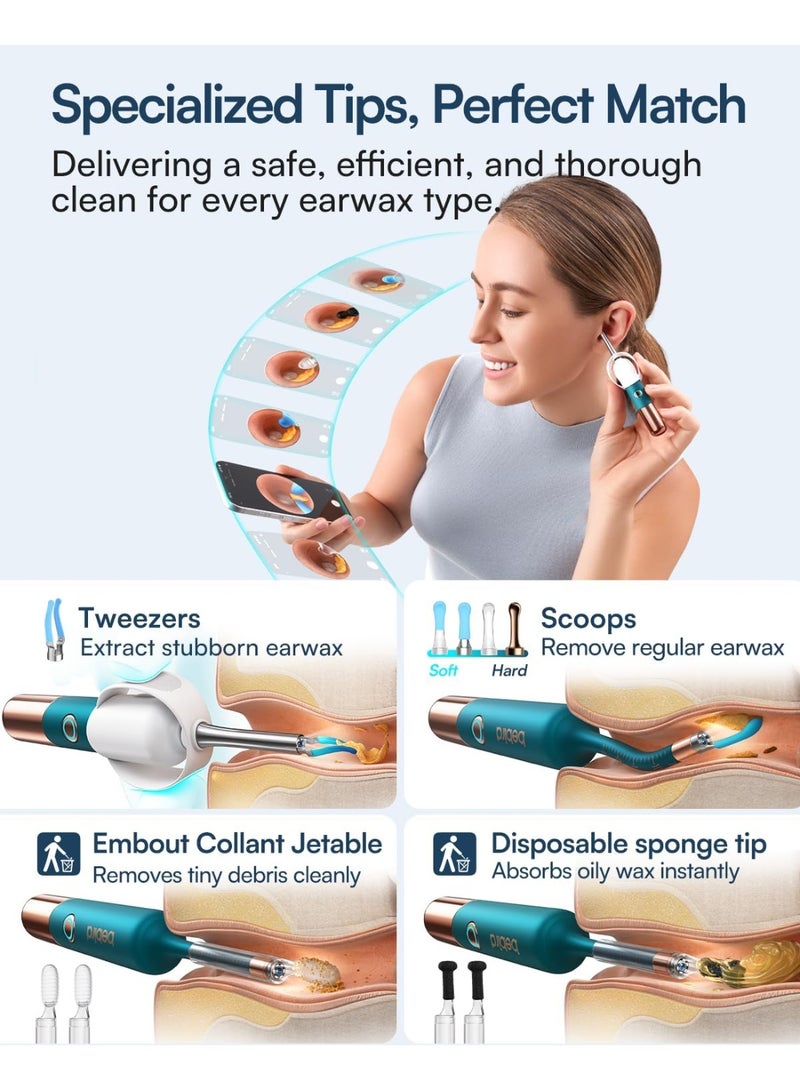 بيبيرد جهاز BEBIRD EarSight Ultra 5G WiFi لتنظيف الأذن والعناية بها، مزود بكاميرا منظار أذن مرنة، ومجموعة إزالة شمع الأذن مع 30 ملحقًا، آمن للاستخدام المنزلي - أزرق فيروزي - Image 5