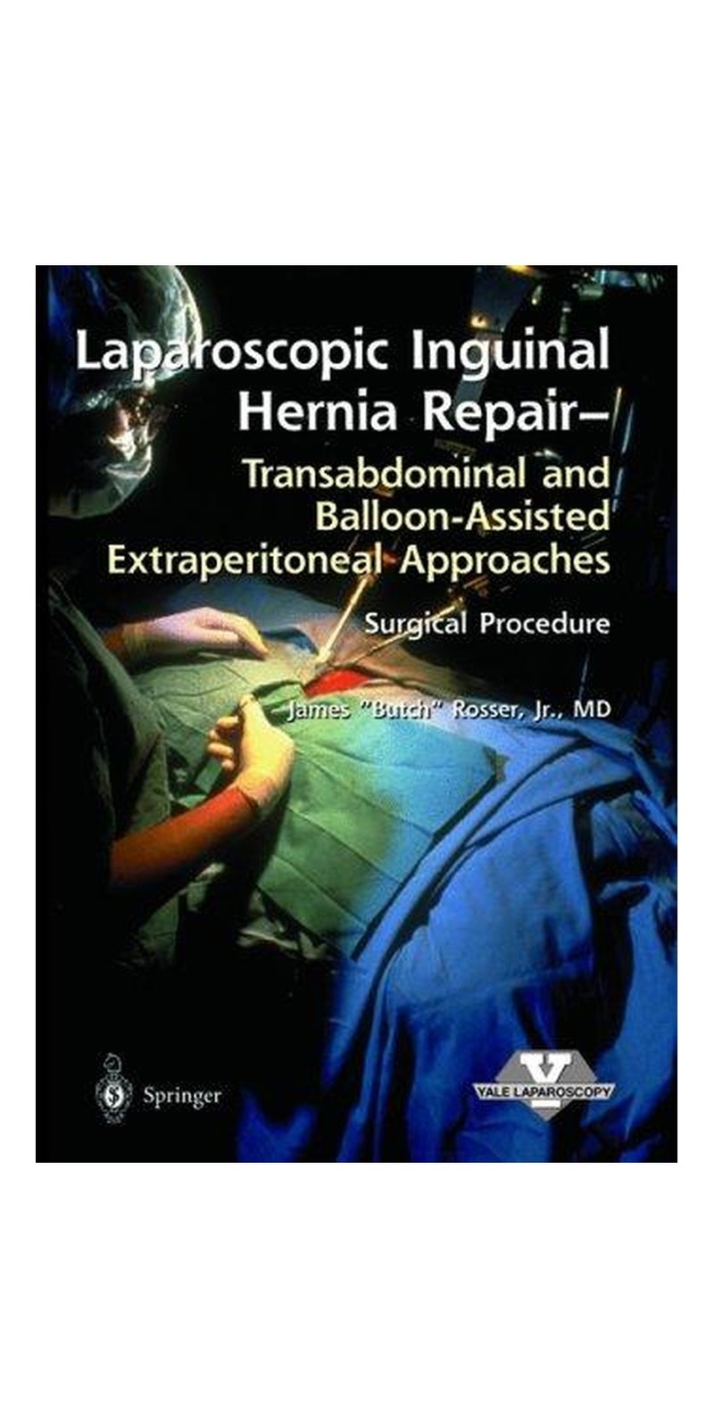Laparoscopic Inguinal Hernia Repair (Laproscopic Surgical Technique) | Authored by James Rosser | Paperback | Published by Springer