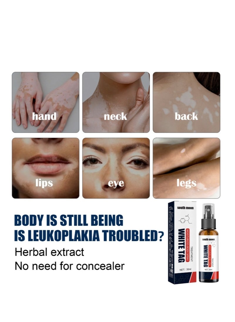 SOUTH MOON White Tag Spot Remover Spray Vitiligo Ointment,  For Skin Vitiligo, Vitiligo Care Cream For Reduce White Spots Repair Spray 30ml  - Image 2