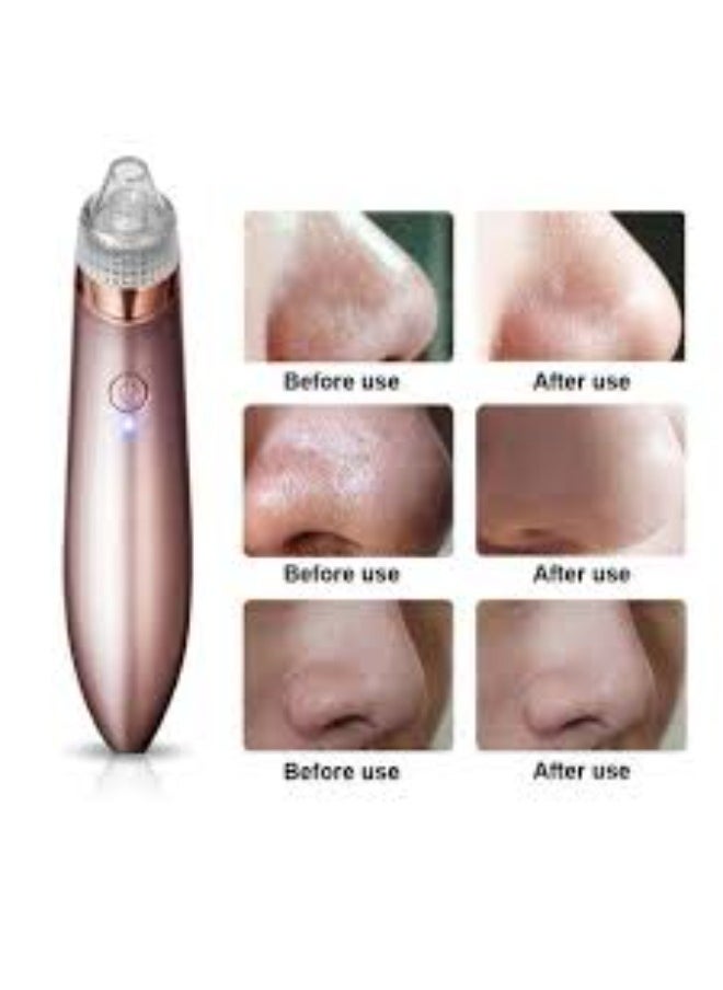 Generic - Get clear and radiant skin with the Facial Fat Suction Device, designed to effectively remove blackheads and excess oils. Featuring advanced suction technology for deep pore cleansing, it helps reduce acne appearance and gives you smooth, healthy skin. Suitable for all skin types and easy to use at home. - Image 1