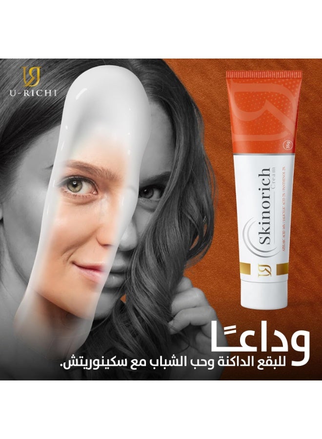 U-RICHI Skinorich Azelaic Cream for Acne, Pigmentation, and Even Skin Tone, with Azelaic Acid and Salicylic Acid, 35g - Image 4