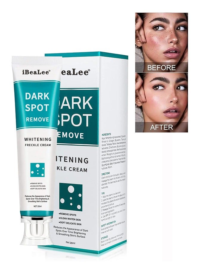 iBealee Dark Spot Remover Whitening Freckle Cream 20ml, Dark Spot Corrector for Face and Body, Effective Cream for Dark Spot Removal, Skin Brightening - Image 1