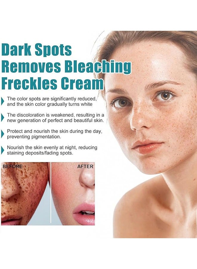 iBealee Dark Spot Remover Whitening Freckle Cream 20ml, Dark Spot Corrector for Face and Body, Effective Cream for Dark Spot Removal, Skin Brightening - Image 3
