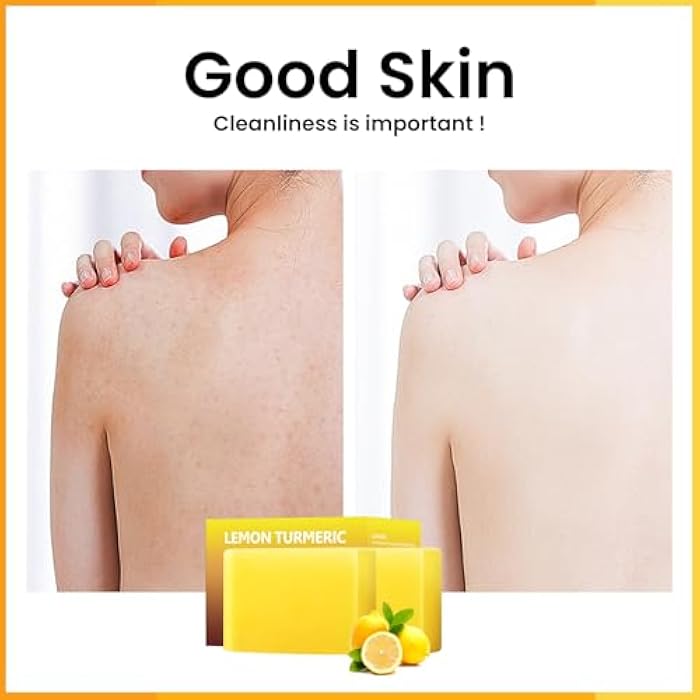 YAFUSIPE Lemon Turmeric Kojic Acid Soap Bar, Turmeric Soap for Face Body Hands, Deep Cleansing Natural Curcuma Bath Soaps Bar, Moisturizing Facial Cleanser Body Wash for All Skin Types Blemish 2 Bars - Image 3