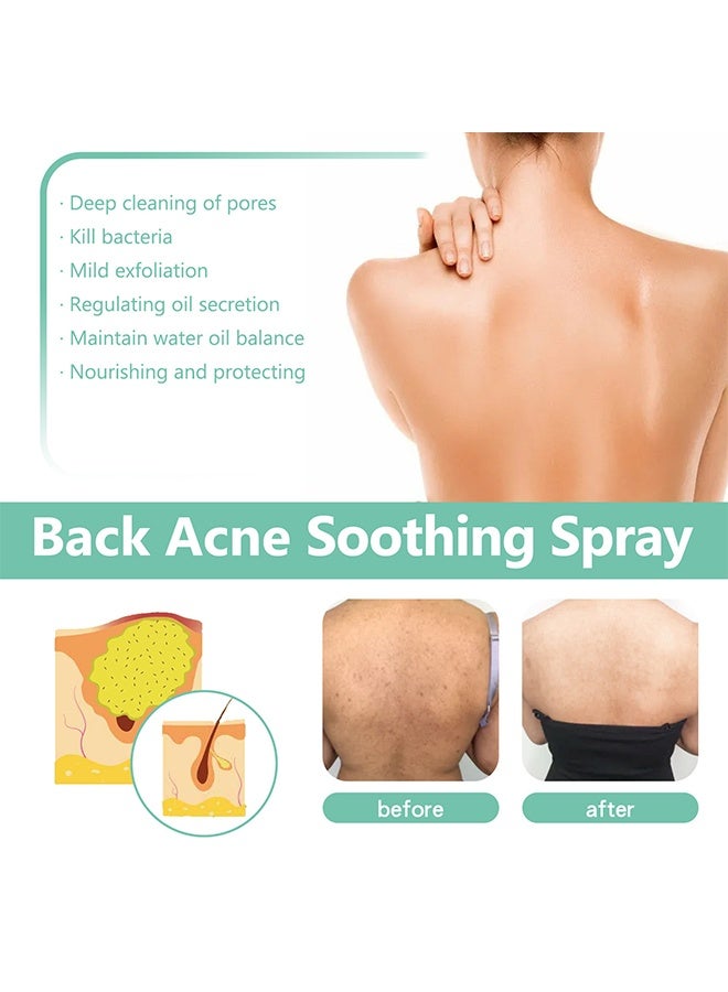 EELHOE Back Acne Soothing Spray, Back Acne Spray, 2% Salicylic Acid Spray, Body Acne Treatment with Herbal Formula, Body Acne Spray, Tea Tree Oil Spray, Acne Treatment For Teens, Back Acne 120ml - Image 3