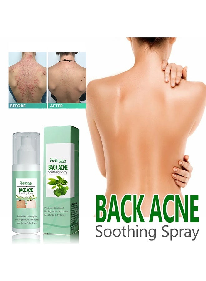 EELHOE Back Acne Soothing Spray, Back Acne Spray, 2% Salicylic Acid Spray, Body Acne Treatment with Herbal Formula, Body Acne Spray, Tea Tree Oil Spray, Acne Treatment For Teens, Back Acne 120ml - Image 1