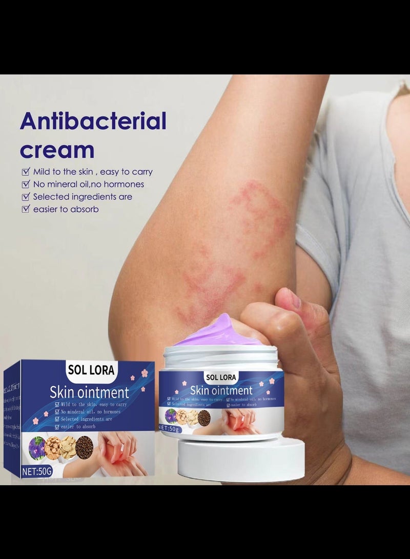 SOL LORA Skin Itch Relief Cream Antibacterial Topical Insect Bites Itchy Skin 50g - Image 2