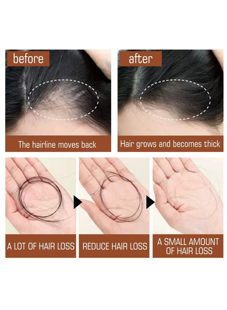 EELHOE 100% Unrefined Batana Oil Hair Growth Products for Men and Women Rapid Growth Anti-Hair Loss - Image 3