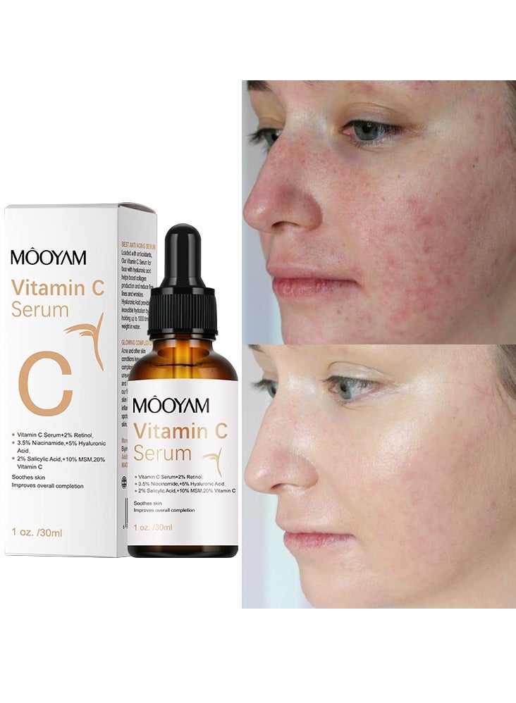 MOOYAM Vitamin C Face Serum for Wrinkles & Anti-Aging – Brightening Serum with Hyaluronic Acid  - Image 2