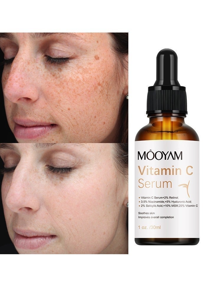 MOOYAM Vitamin C Serum for Face with Hyaluronic Acid Retinol and Salicylic Acid Anti Aging Facial Serum for Wrinkles Dark Spots and Brightening Improves Skin Tone and Texture 30ml - Image 5