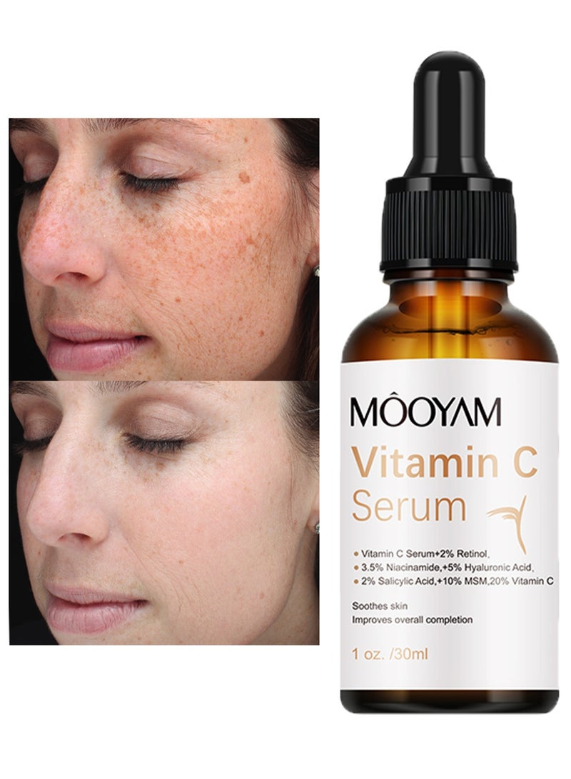 MOOYAM Vitamin C Serum for Face with Hyaluronic Acid Retinol and Salicylic Acid Anti Aging Facial Serum for Wrinkles Dark Spots and Brightening Improves Skin Tone and Texture 30ml - Image 1
