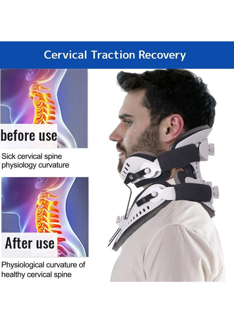 AROAQ Neck Brace Support,  Adjustable Cervical Collar, Comfortable Fixable Neck Posture Corrector, Neck Pain Spine Pressure Traction Device For Neck Pain Posture Support, (1pc, Grey) - Image 3