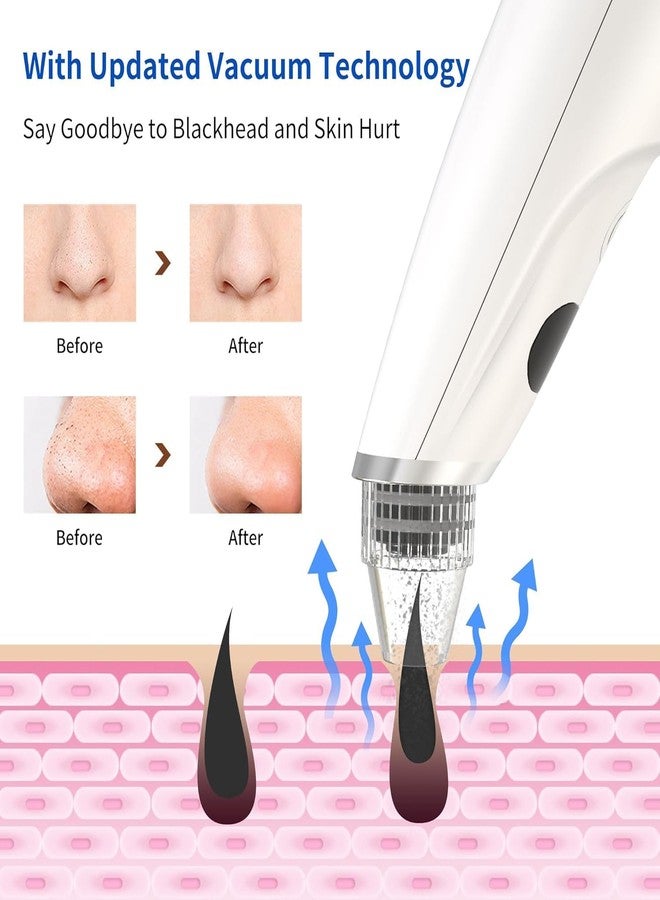 Docoss Ultrasonic Black head Remover Tool -Rechargeable White heads & Blackhead Removal Machine for Nose with 5 Suction Levels and Probes, Pore Cleansing Machine for Skin Lifting & Brighter Face - Image 3