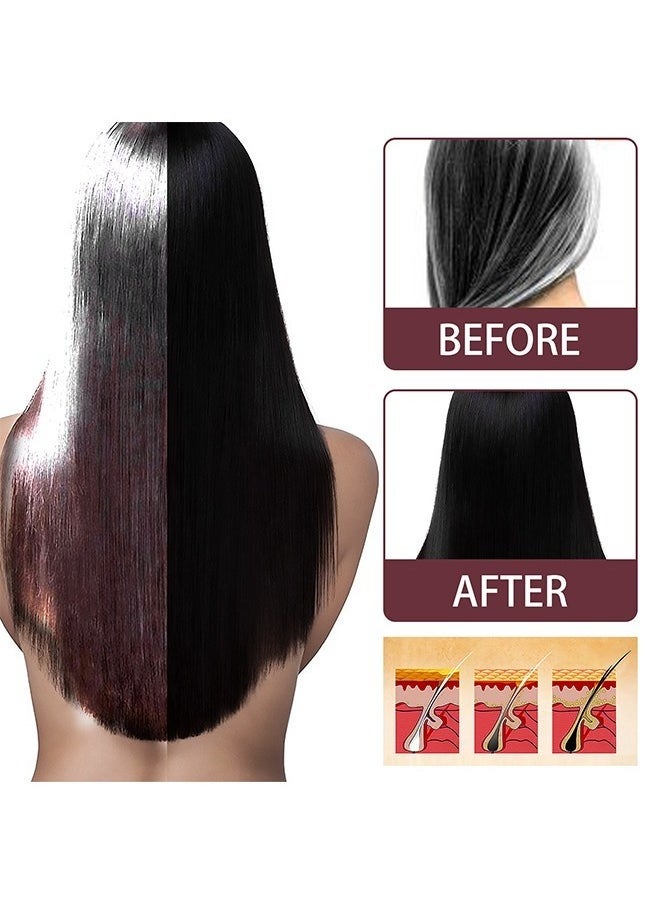 SOUTH MOON Herbal Anti-Gray Hair Spray 100ML - Herbal Treatment Growth Essence Spray Tonic | for Black Hair Restoration, Anti-Hair Loss  - Image 4