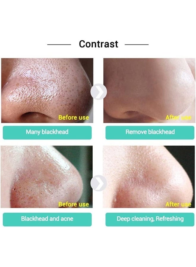 شرائط أنف نباتية، شرائط أنف لابينا النباتية، مزيل الرؤوس السوداء، شرائط مزيل الرؤوس السوداء - Image 3