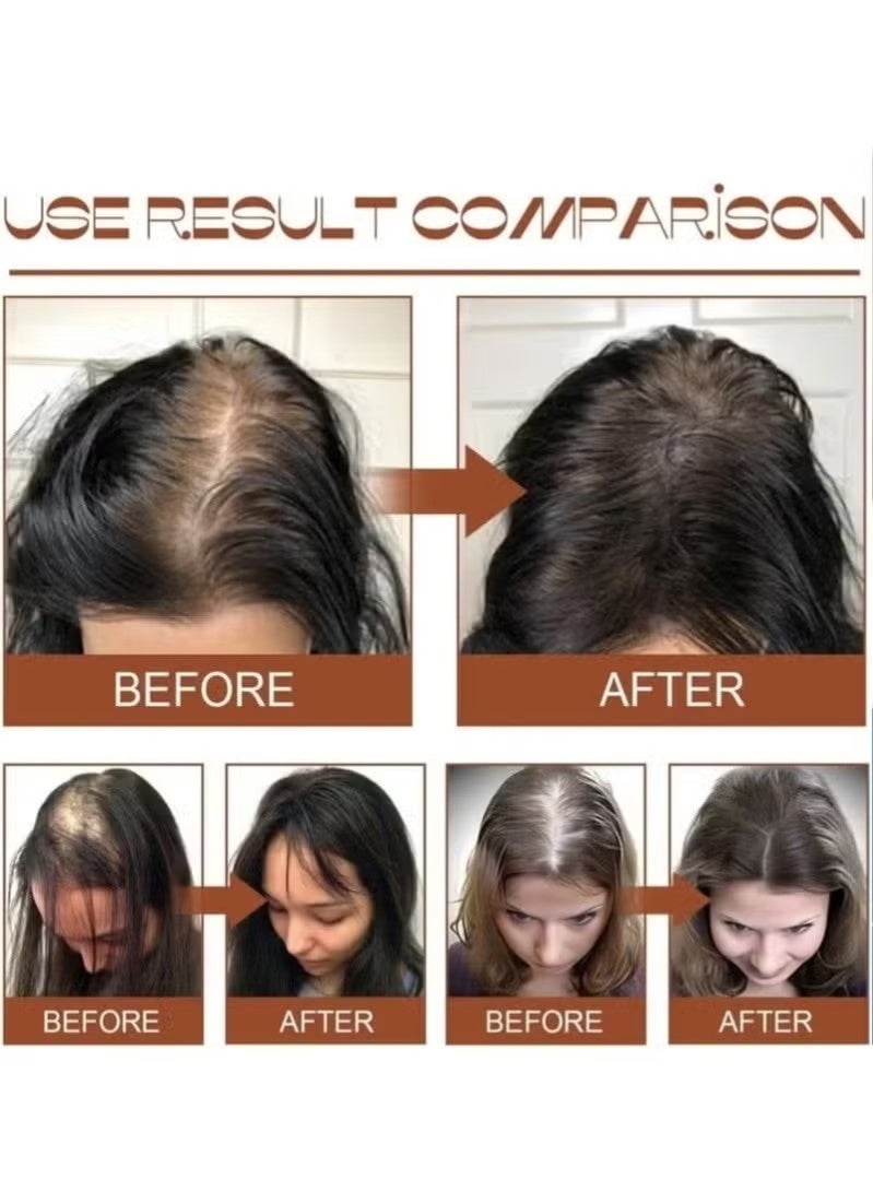 EELHOE Batana Oil for Hair Growth Healthier Thicker Fuller Hair, Batana oil, Batana Oil for Hair Growth, Batana Oil Organic, Batana Oil Organic for Healthy Hair, Batana Oil Hair Mask - Image 2