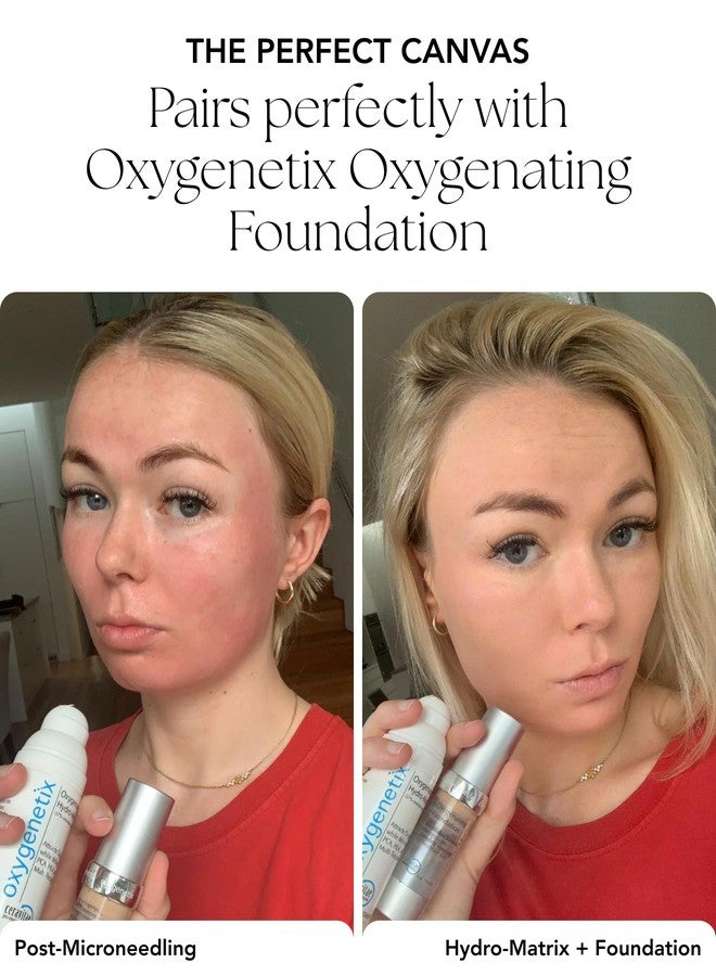 Oxygenetix Oxygenating Hydro-Matrix (1.7oz | Lightweight Aloe-Based Face Moisturizer with Hyaluronic Acid for Sensitive, Dry, or Compromised Skin - Image 5
