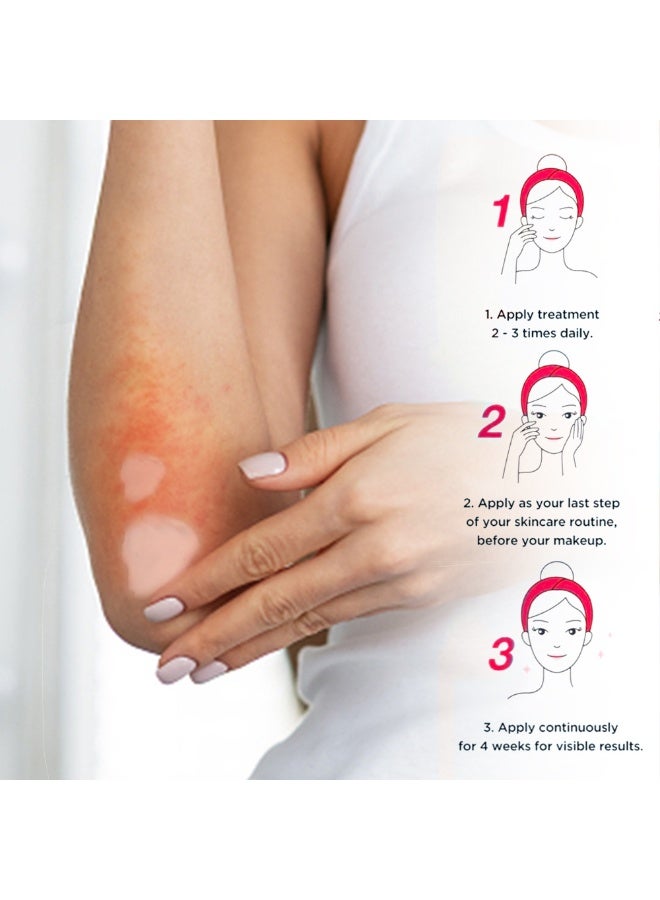 Sumifun Calamine Eczema Relief Cream,100g Healing Skin Care Cream for Eczema - Image 3