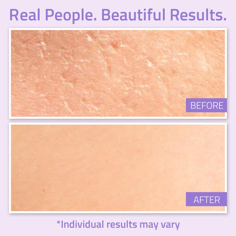 YEOUTH Hyaluronic Acid Moisturizer Face Cream with Vitamin C & E, Ferulic Acid & Tripeptide 31, Hydrating Face Moisturizer, Hyaluronic Acid Cream Suitable for Dry & Dull Skin 1oz - Image 4