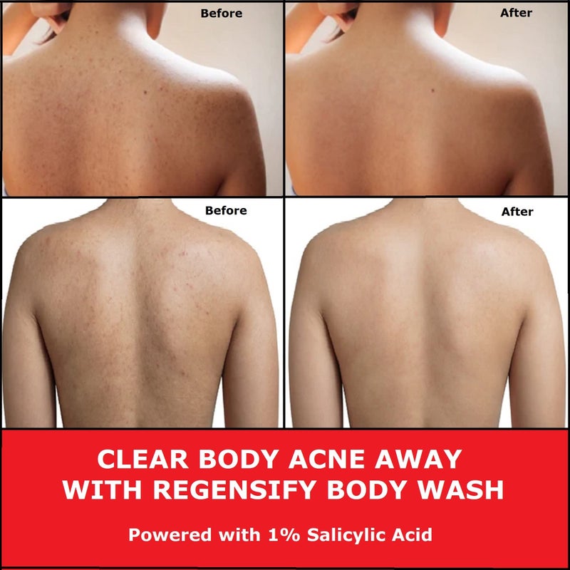 REGENSIFY Red Acne Body Wash 500 ml (17 FL Oz) [1% Salicylic Acid, Niacinamide, Panthenol, Hyaluronic Acid, Coenzyme Q10 & Vitamin E] - Anti Aging, Hydrating, Moisturising & Exfoliating Shower Gel - Image 5