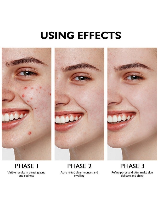 ليكرين 10٪ معزز حمض الأزيليك - علاج يقلل من البقع الصبغية والبثور والجلد الملطخ - بحمض الأزيليك وحمض الساليسيليك - جميع أنواع البشرة - 30 مل - Image 3