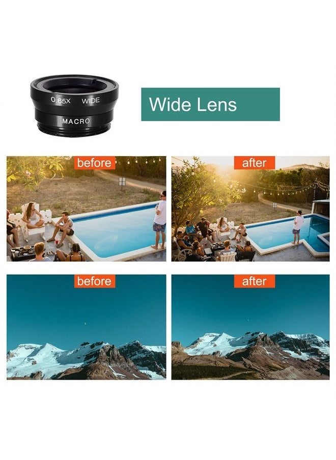 Ailun - Phone Lens,by Ailun,3 in 1 Clip On 180 Degree Fish Eye Lens+0.65X Wide Angle+10X Macro Lens,Universal HD Camera Lens Kit for Mobile Phone,Cellphone,Smart Phone - Image 1