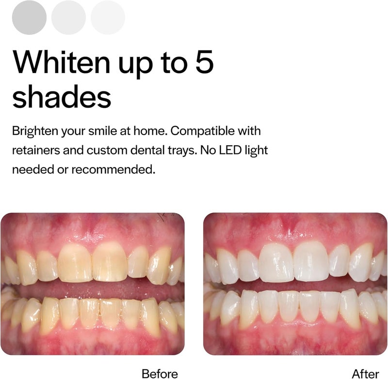 Opalescence Mint 35% PF Refill Kit - Image 4