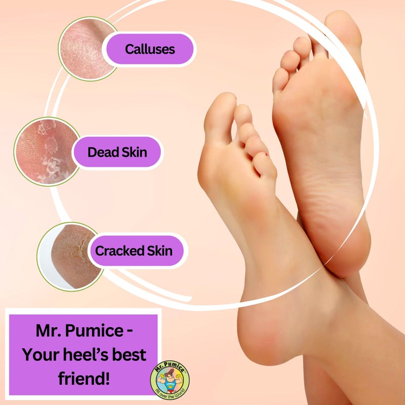 Mr. Pumice Purple PUMI Bar - Extra-Coarse, Pumice Stone for Feet Callus Remover, Pedicure Tools for Feet, Foot Scrubber for Dead Skin Remover, Foot Care, 6 Pack - Image 3