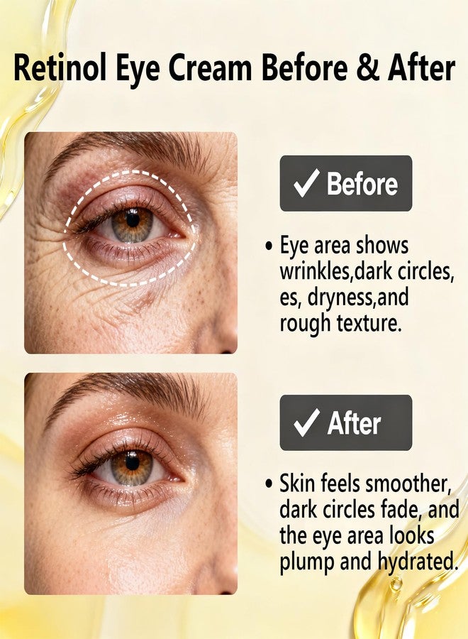 sunohyesla Retinol Under Eye Cream,Vitamin E & Niacinamide – Reduces Appearance of Wrinkles & Dark Circles&Puffiness, Anti-Aging Eye Cream for Fine Lines,Daily & Night Use,Men & Women (1 fl.oz - Image 4