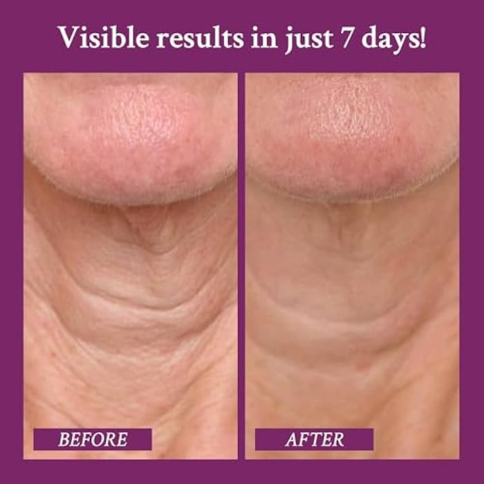 PRAI Neck Creme for Tightening & Firming Beauty | Neck Firming Cream That Boosts Elasticity | Cruelty & Paraben-Free Vegan Neck Tightening Cream | Neck and Chest Firming Cream With Hyaluronic Acid - Image 3
