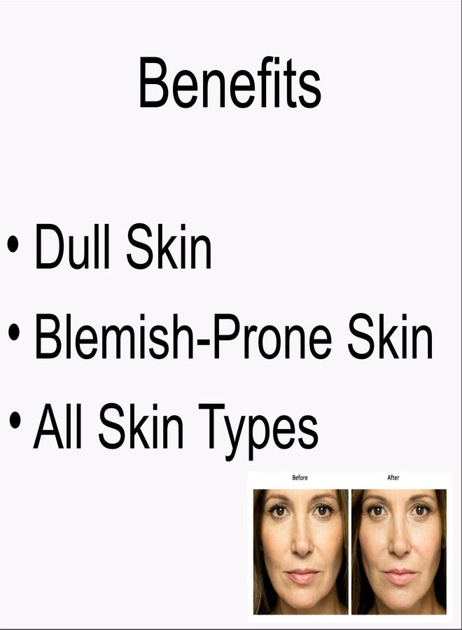 Pink Square Alpha Arbutin Serum for Glowing Skin (Pack of 3, Each 30 ml)|Serum for Face, Maintain Acne and Dark Spots Anti-Pigmentation Face serum for Men and Women Helps Remove Blemishes and Acne| - Image 4