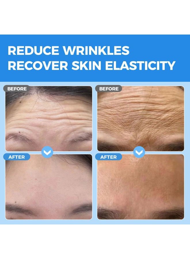 OKELA Forehead Wrinkle Patches Overnight 20 pcs with Collagen, Anti Wrinkle Patches, Forehead Wrinkles Beauty Treatment - Image 2